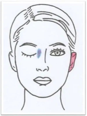 Antlitz-Analyse Nr 03 Ferrum phosphoricum