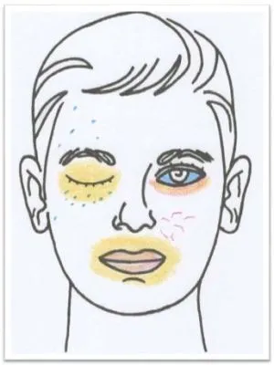 Antlitz-Analyse Nr 04 Kalium chloratum