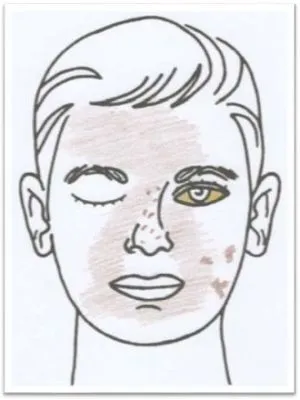 Antlitz-Analyse Nr 06 Kalium sulfuricum