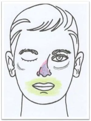 Antlitz-Analyse Nr 10 Natrium sulfuricum